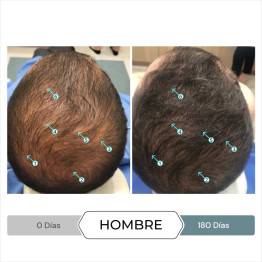 DS REVITA SOD ANTIOXIDANTE... 2